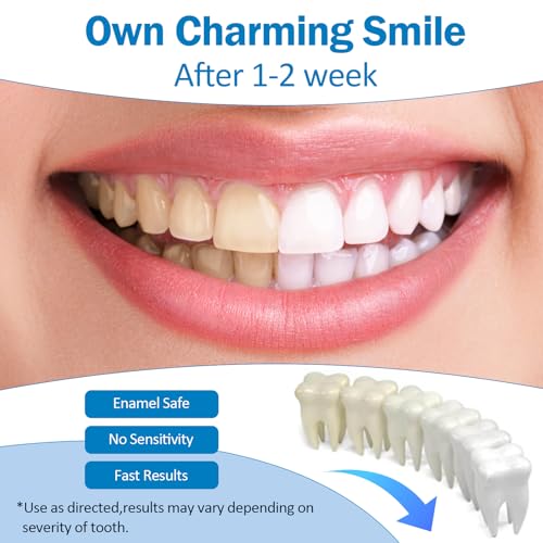 Image of Teeth Whitening Pen