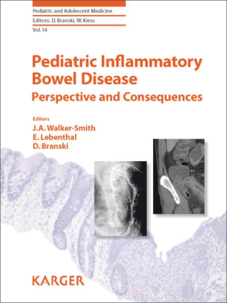 Buy Pediatric Inflammatory Bowel Disease: Perspective and Consequences (Pediatric and Adolescent Medicine) — BookShops.in