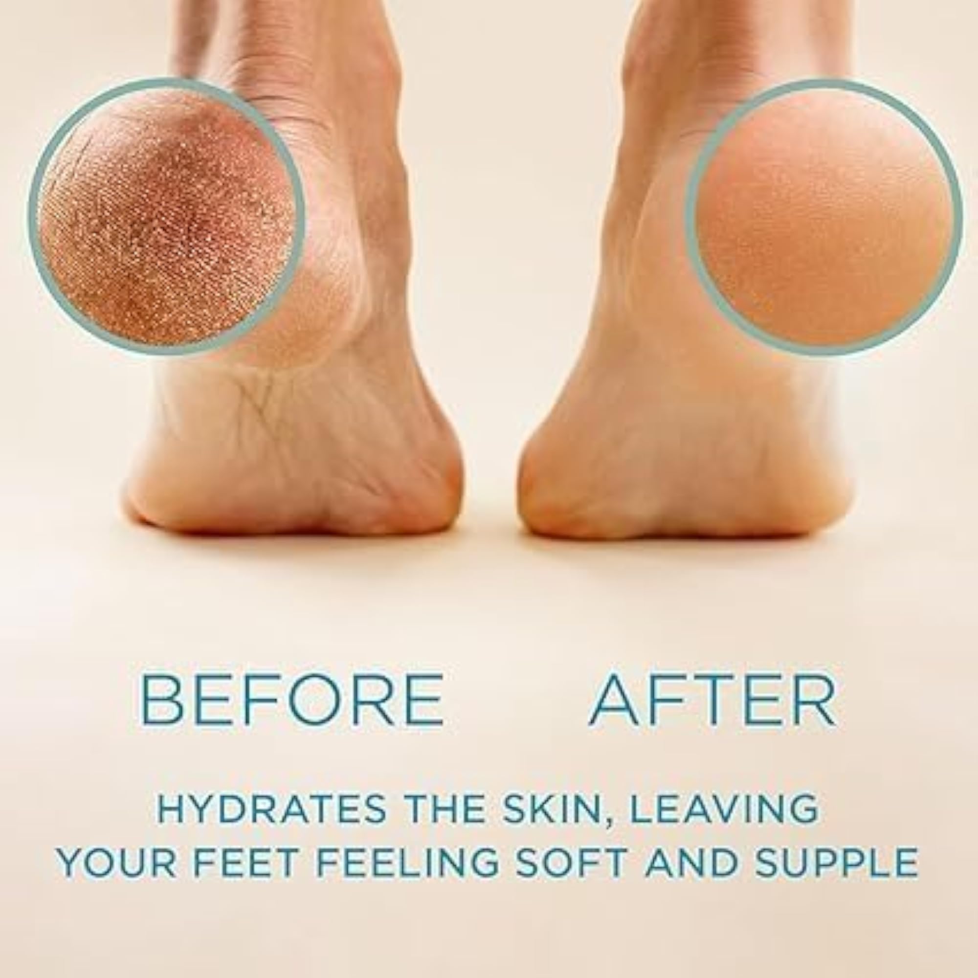 Turmeric Super Whitening Foot Peeling Gel