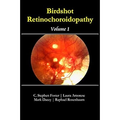 Birdshot Retinochoroidopathy