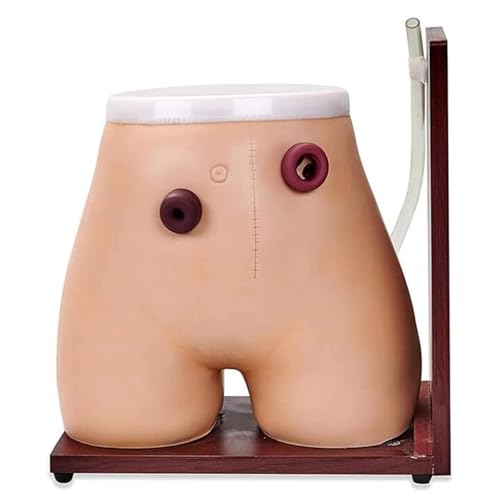 Modelo Avanzado De Enfermería De Fístula Y Ostomía, Modelo De Colostomía E Ileostomía a Tamaño Real, Modelo De Práctica Docente con Maniquí, para La Docencia Médica De Enfermería.