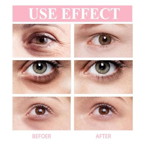 Retinol Eye Stick,Retinol Eye Cream for Dark Circles and Puffy Eyes,Eye Cream for Wrinkles,Under Eye Cream Anti Aging,Eye Bags Remover,Eye Care Products,Instant Wrinkle Remover,Firming Eye Cream - Image 3