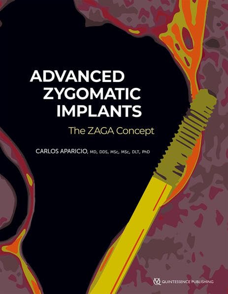 Cover for Advanced Zygomatic Implants: The Zaga Concept