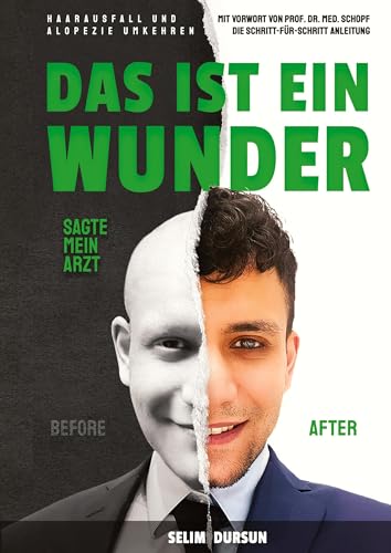 Das Ist Ein Wunder Sagte Mein Arzt: Haarverlust Und Alopezie Umkehren (German Edition)