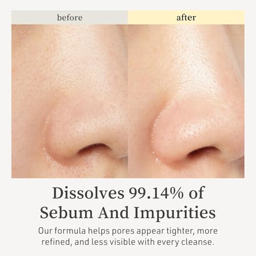 NOONI Korean Cleansing Oil - Snow Aqua 0 LHA Toning Cleansing Oil | Makeup Blackhead Remover, Pore Control, Glass Skin, Help Control Sebum, Revitalizing, Moisturizing, Gifts For Women, 6.76 Fl Oz