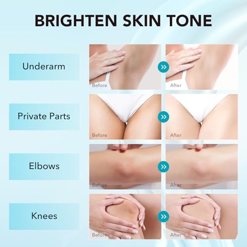VZP Skin Bleaching Cream, Skin Lightening for Intimate Areas, Moisturizing Cream Contain Vitamin C for Underarm, Armpit, Knees, Elbows, Inner Thighs and Bikini Area (1.7 Fl Oz)