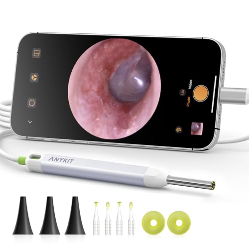 Anykit Ear Wax Camera Otoscope – Type-C, 6 LED
