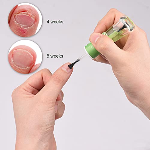 Montloxs 2-in-1 10 ml plantenextractie-olie voor bittere nagelreparatiekwasten pen effectieve behandeling nagelschimmel… - Afbeelding 4