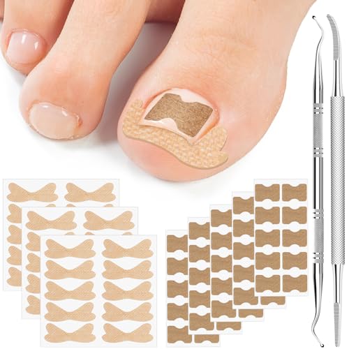 Ingrown Toenail Treatment, 50Pcs Breathable Corrector Patch, 30Pcs Ingrown Toenail Strips, Painless Ingrown Toenail Corrector Set with 2 Pedicure Tools, Not Easy to Fall Off