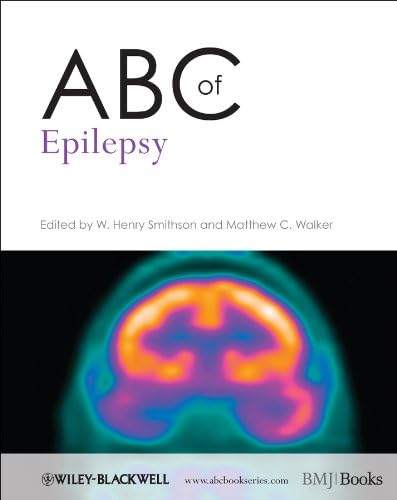 ABC of Epilepsy: 183