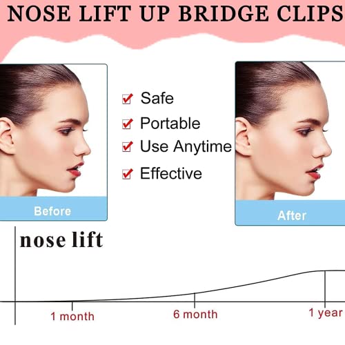 Image of Nose shaper for women for big and small nose bridge uplifting clip for men nose straightener nose shaping tool nose up beauty clipper (Pink with White) (Pink)