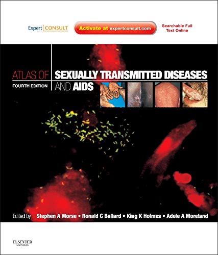Buy Atlas of Sexually Transmitted Diseases and AIDS: Expert Consult — BookShops.in