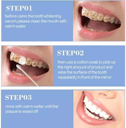 VELCOM DazzleBright Advanced Teeth Whitening Essence for Brilliant Smiles (Pack 1)