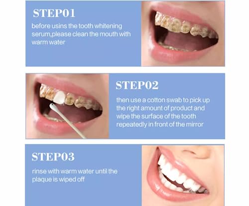 VELCOM DazzleBright Advanced Teeth Whitening Essence for Brilliant Smiles (Pack 1)