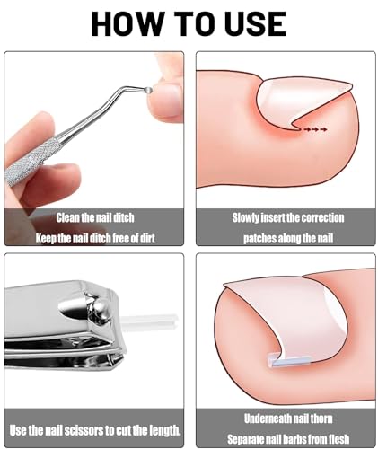 Image of 10 PCS Toenail Corrector Strips, Toenail Support Strips, Breathable Nail Care Patches for Daily Comfort Ingrown Toenail Pain Reliever