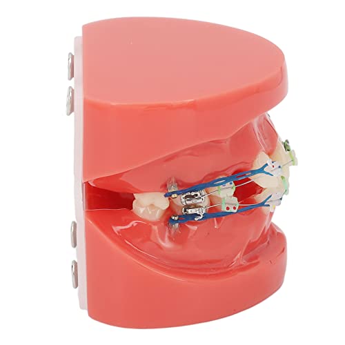 Zahnspange-Studienmodell, Typodonts-Demonstrationsmodell Mit Metalldrähten Und Halterung, Typodont-Zahnmodell Für Studium Und Lehre