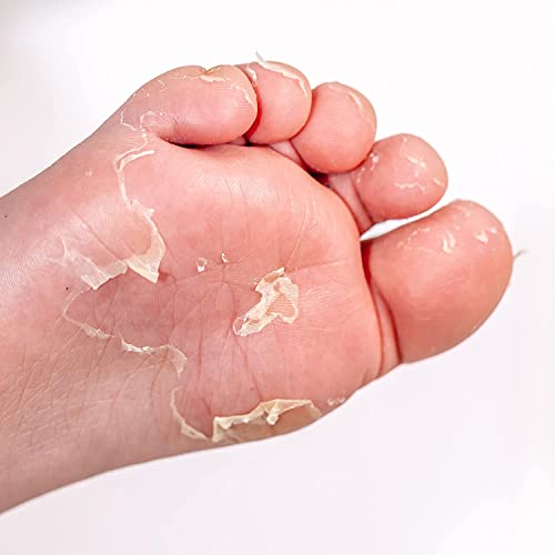 Onyx Professional 74746 Foot Peel Mask Callus Remover (2 Pack) Dead Skin Remover thumb #4