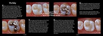 Hardcover Highly Esthetic CEREC Solutions Book