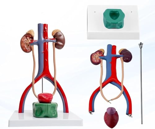 Modelo anatómico del sistema urinario masculino humano, representación de tamaño real de riñones, glándulas suprarrenales, uretra y vejiga para entrenamiento médico