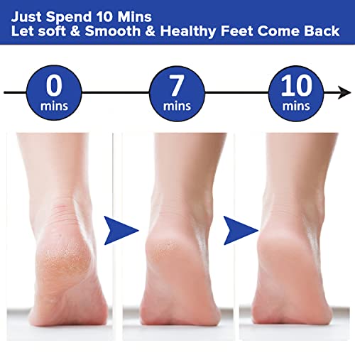 Image of Dr Foot 40% Urea Gel Moisturizes Callus Cracked Rough Dry Dead Skin- 100Gm & File Callus Remover | For Dead Skin, Calluses, Cracked Heels & Hard Skin Remover - With Free Brush