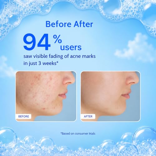 Image of Deep Cleansing Hydrating Face Wash for Oily, Acne-Prone & Dull Skin | 2% Salicylic Acid, 6% Niacinamide, Hyaluronic Acid & Vitamin C | Oil Control, Brightening & Pore Cleansing Face Cleanser for Men & Women | 100 ml