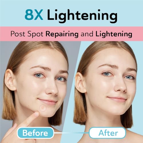 DERMA ANGEL Dark Spot Patches Blemish Patches with Hydrocolloid, TXA & CICA for Active Acne & Post-Inflammatory Dark Spots - Day and Night Use - UPGRADED (Post Acne - 96 Count - 1 Size)