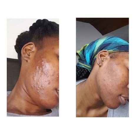 In'Oya Crema Mon Soin Anti-Imperfections