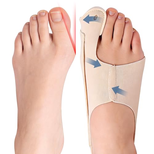 Yiciwoc Bunion Corrector for Women & Men, [2-Pack] Comfortable Hallux Valgus Relief Splint, Discreet Soft Toe Straightener for Fits in Shoes, Adjustable Alignment Support for Day and Night