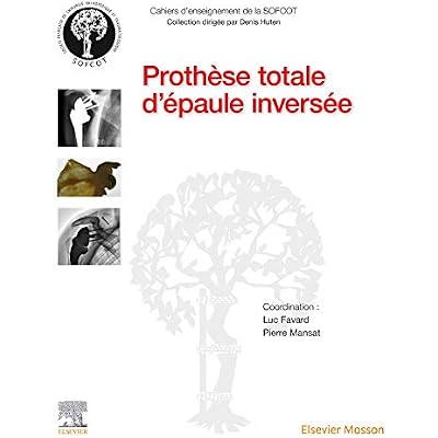 Proth&egrave;se totale d'&eacute;paule invers&eacute;e
