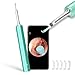 Produktbild BEBIRD Otoskop Ohrreiniger Mensch Ohr Endoskop Tool Wireless Ohr Reiniger mit 1080P HD Kamera & 4 austauschbare Ohr Picks für Kinder Erwachsene kompatibel mit iPhone Android Phone(Dark Blue)
