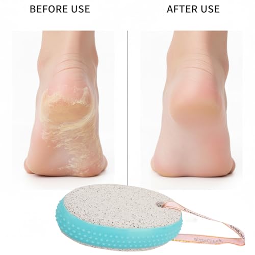 Image of Midazzle Oval Shaped Pumice Stone with Grip (Pack of 2)