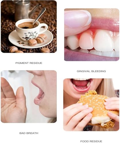 Niacinamid Whitening Zahnpasta, komplette Pflege-Zahnpasta, entfernt Zahnstein und erfrischt den Mund (2) – Bild 7