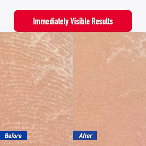 Heal&Rescue Heel Rescue Super Crack Foot Cream, Concentrated AHA Blend & Shea Butter, Moisturizes, Exfoliates, Softens & Aids Cracked Heel Repair, 4.4 Ounce