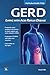 GERD: Living with Acid Reflux Disease (MyModernHealth FAQs)