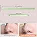2-in-1 Professional Stainless Steel Acne Removal Needle, Whitehead&Blackhead Remover Tool, Pimples Comedone Extractor Removal Tool, Double Ended Needle with Cap Removal for Nose Face Tools(Rose Gold)