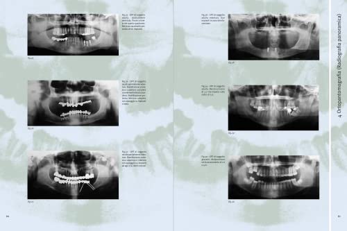 Atlante Di Radiologia Odontoiatrica. A Fini Diagnostici - 9