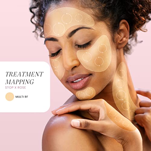 Tripollar Stop X - High Rf Radio Frequency Facial Skin Tightening Machine, Wrinkle & Anti-Aging Device (Us Version) - Professional Skin Lifting By Accelerating Natural Production Collagen #TOP3