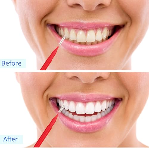 Image of Patelai 100 Pieces Braces Dental Brush for Cleaner Interdental Toothpick Dental Tooth Flossing Head Oral Hygiene Flosser Toothpick Cleaners Tooth Tool(Orange,Red,Suitable Size)