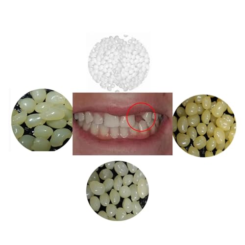 sowsmile Latest 4 colors Temporary Moldable False Teeth Repair Replacement Thermal Fitting Beads Kit for Teeth Instant Confident Smile Teeth