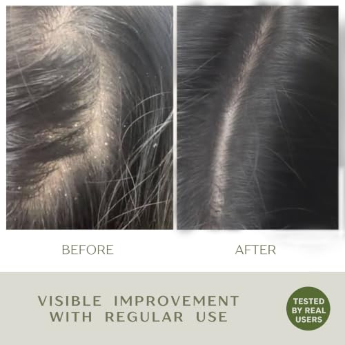 Image of Herbal Shampoo for Hair Fall & Dandruff Control | Concentrated Herbal Decoction with Reetha, Shikakai, Fenugreek & Amla + Pro-Vitamin B5 | 250ml