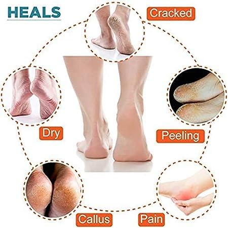 KANAKADHARA Silicone Ankle Gel Socks Half Heel for Dry Hard Cracked Heel Repair Pad, Swelling & Pain Relief, Cushion Support, Foot Care, Ankle Protection, Plantar Fasciitis for Men and Women ( 1 Pair, MULTI COLOR). 2