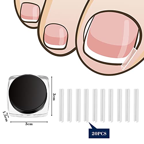 Toenail Unghie Piedi Adesivi per la Correzione