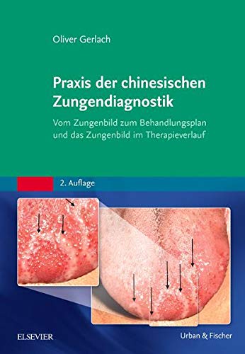 Praxis der chinesischen Zungendiagnostik: Vom Zungenbild zum Behandlungsplan und das Zungenbild im Therapieverlauf