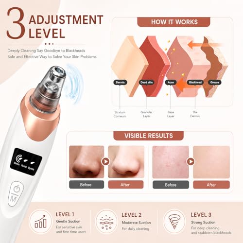 Image of MORTON DAVIES 4 In 1 Multi-Function Blackhead Whitehead Extractor Remover Device Facial Cleansing Tool ,Skin Cleaner,Pimple Removal Tool,Acne Pimple Pore Cleaner Vacuum Suction Tool For Men & Women(White) (5 pro)