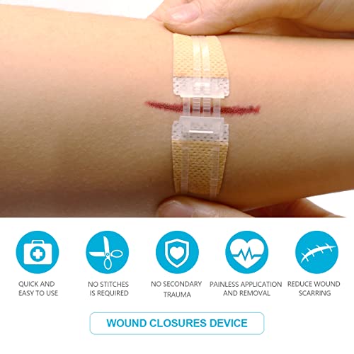 Emergency Wound Closure Device, Sutures Bandaids Kit 2 Pcs- Repair Wounds Without Sew, Great For Outdoor Activities Such As Hiking, Exploring Wild Nature, Quick Clot #TOP1