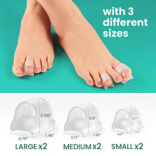 Welnove Toe Separators,Toe Spacer For Overlapping Toe,Bunion Protector,Bunion Corrector,Suitable For Men Women Child,3 Different Size #TOP5