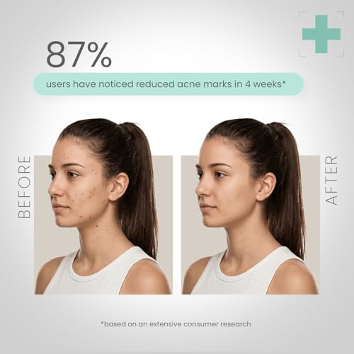 Lotus Herbals Dermabotanics Kojic Acid + Multi Berry Hi-Dose Serum|Reduces Pigmentation & Dark Spots|Calms Redness|Made With Dermatologists|Non-Irritating|Ph 5.5|Suitable For Sensitive Skin|28Ml - Image 6