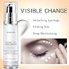 Eye Cream for Dark Circles and Puffiness