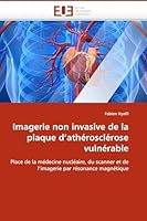 Imagerie Non Invasive de la Plaque d''athérosclérose Vulnérable 6131518521 Book Cover