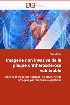 Paperback Imagerie Non Invasive de la Plaque d''athérosclérose Vulnérable [French] Book